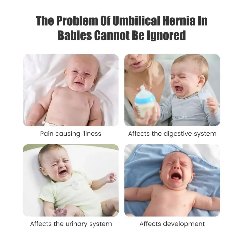 Effects of umbilical hernia on babies with crying infants